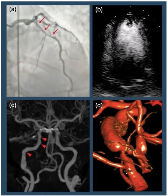 Figure 1