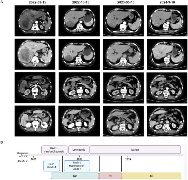 FIGURE 4