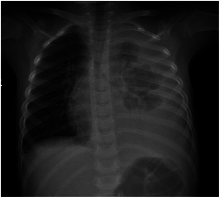 Figure 2