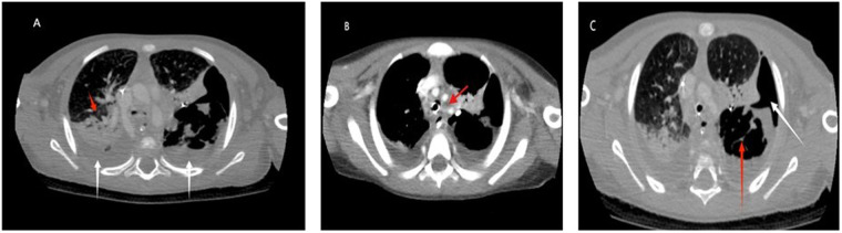Figure 3