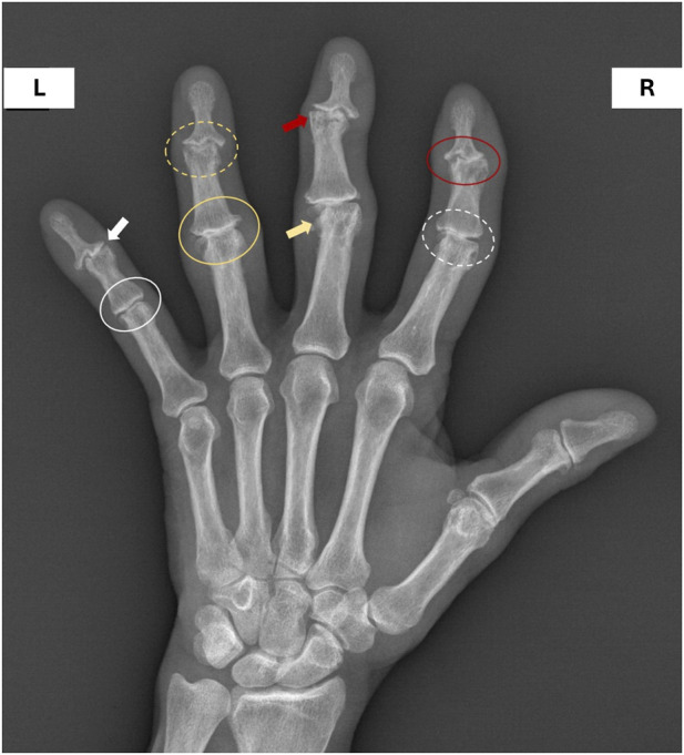 FIGURE 1