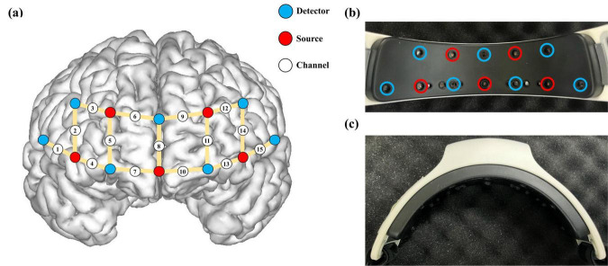 FIGURE 2