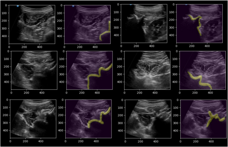 Figure 4