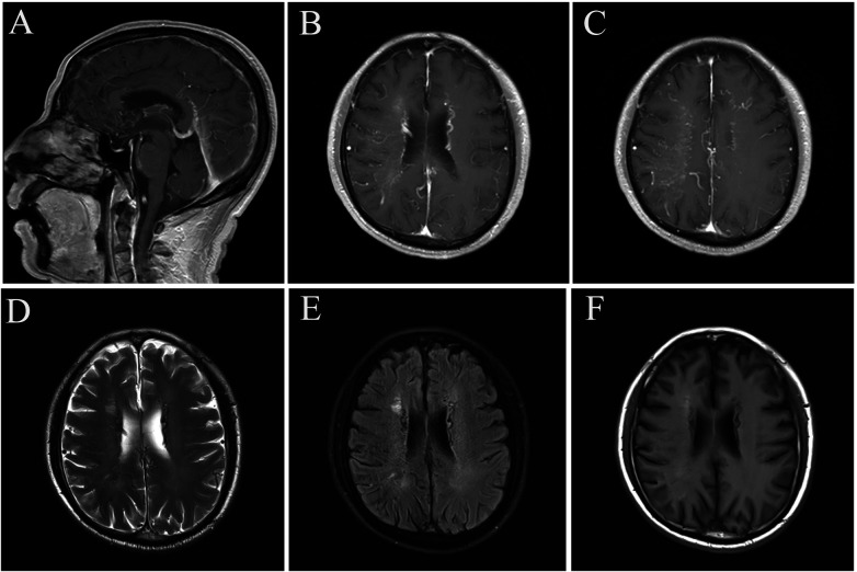 Figure 2