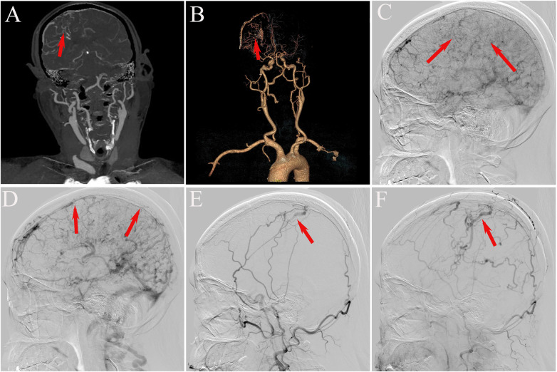 Figure 3