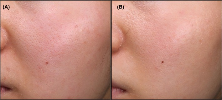 FIGURE 3