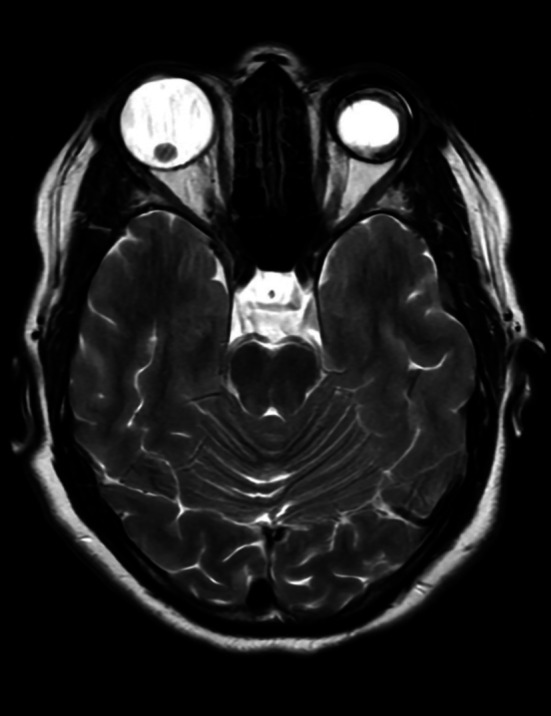 FIGURE 3