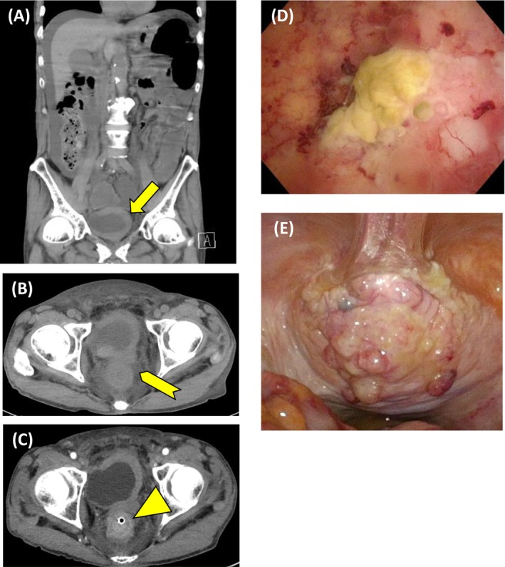 FIGURE 1