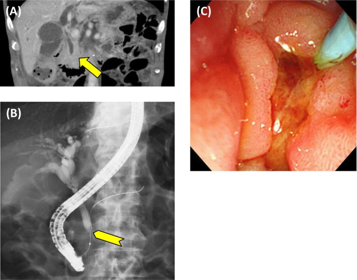 FIGURE 3