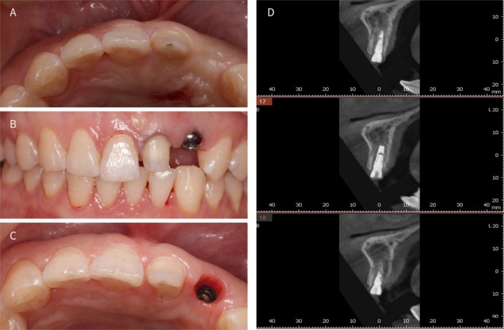 FIGURE 4