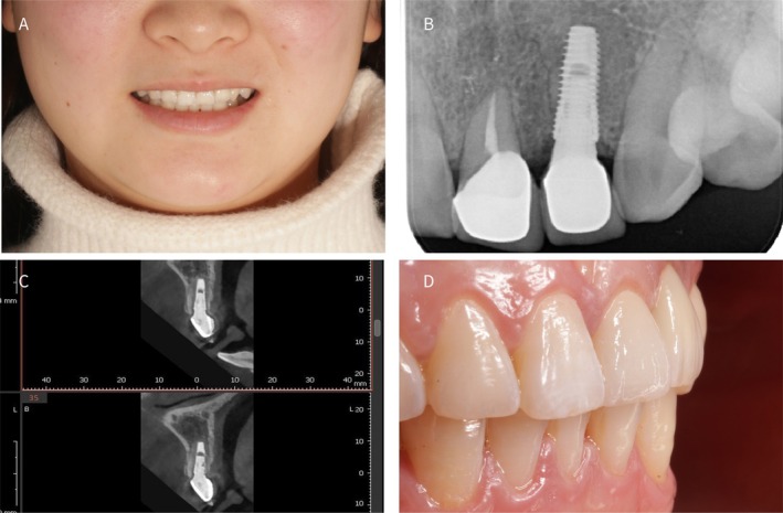 FIGURE 6