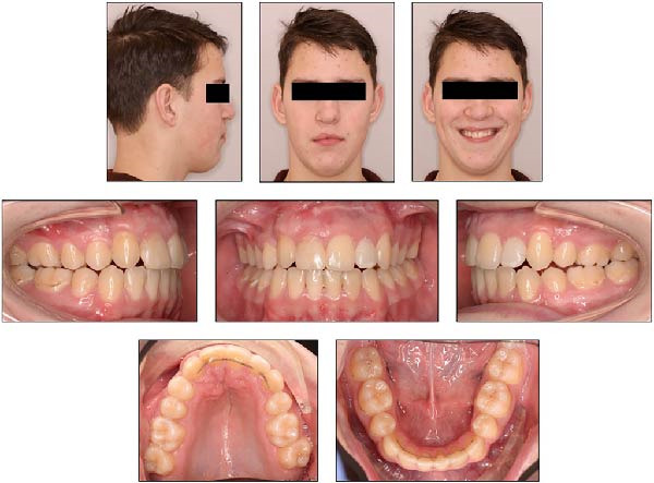 Figure 13