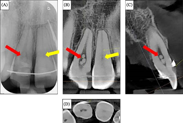 Figure 12