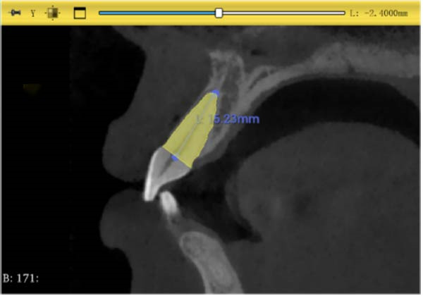 Figure 11