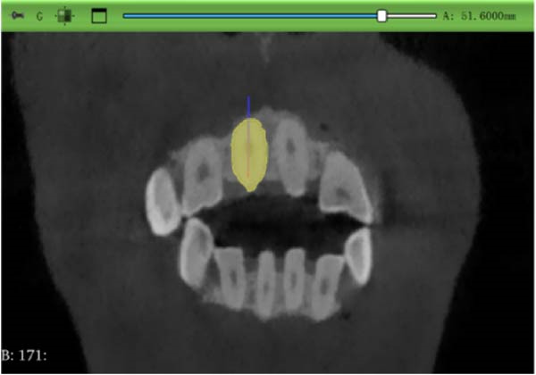 Figure 12
