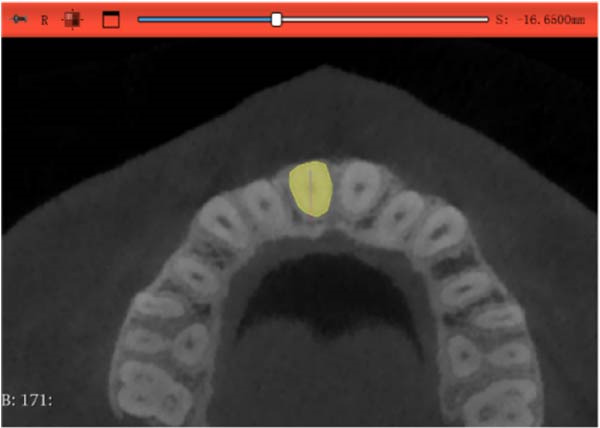Figure 14