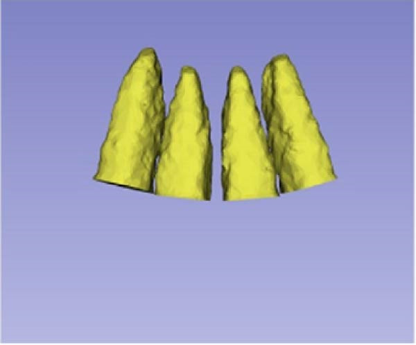 Figure 15