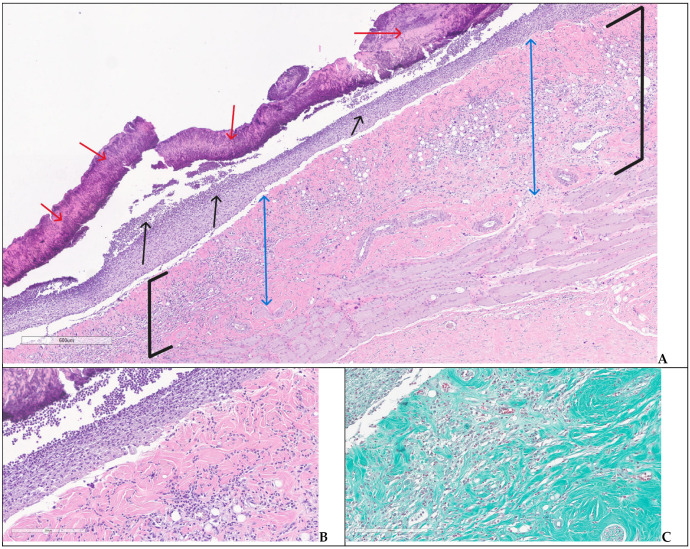 Figure 14