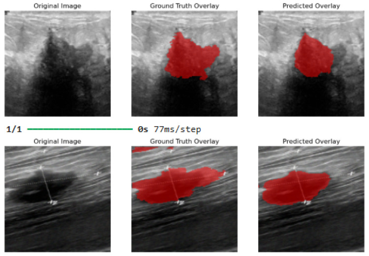 Figure 11
