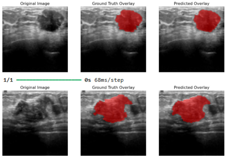 Figure 12