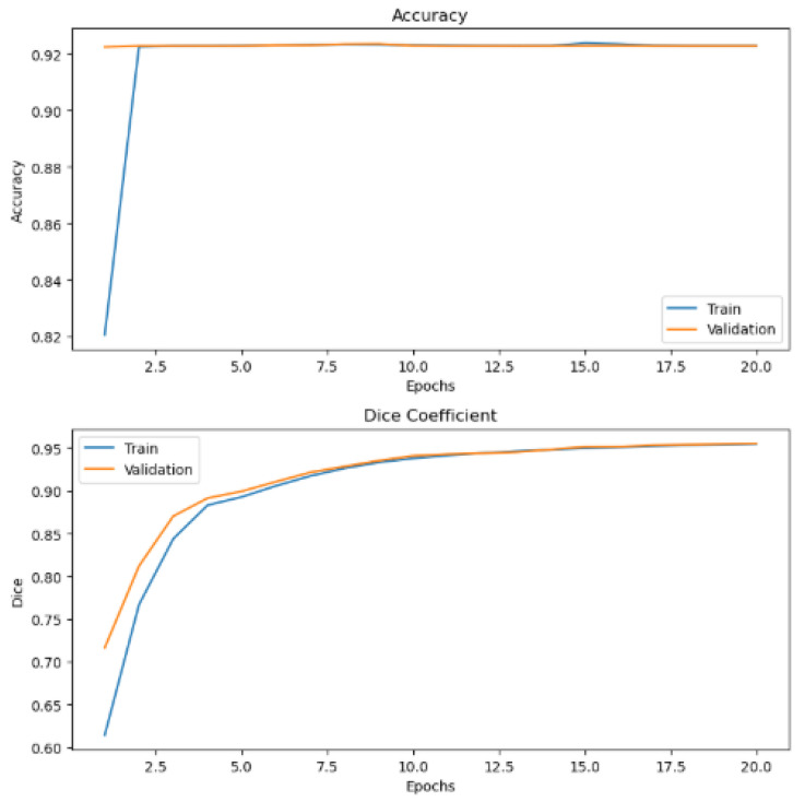 Figure 14