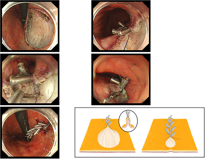 FIGURE 2