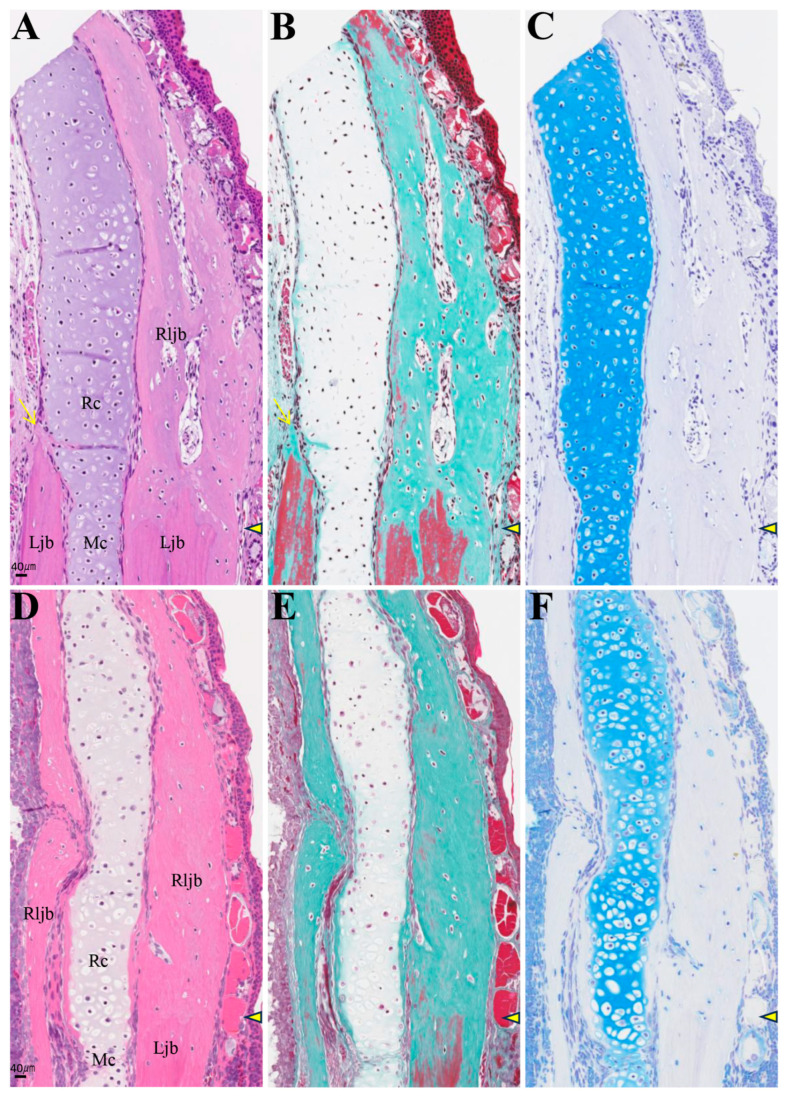 Figure 11