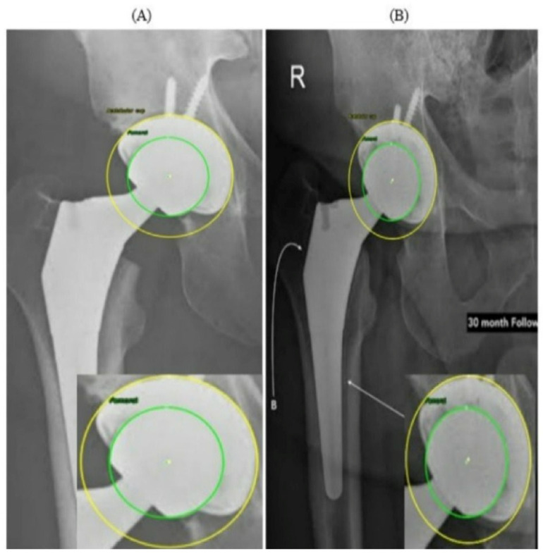 Figure 11