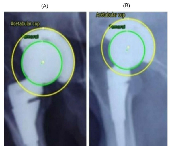 Figure 12