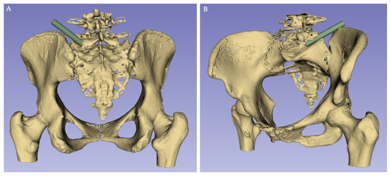 Figure 2