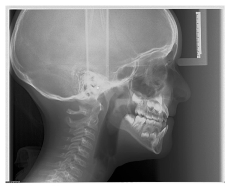 Figure 9