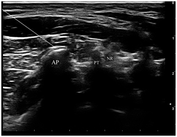 Figure 2