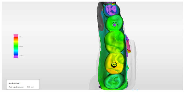 Figure 14