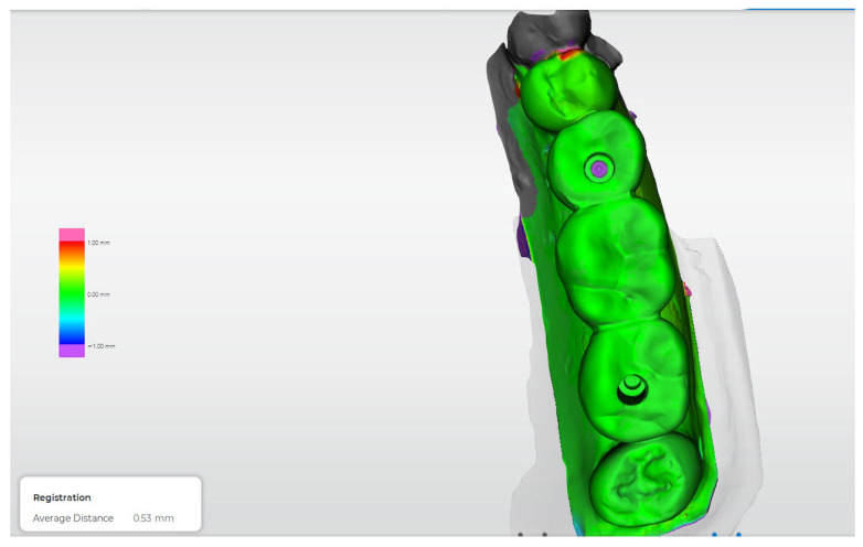 Figure 16