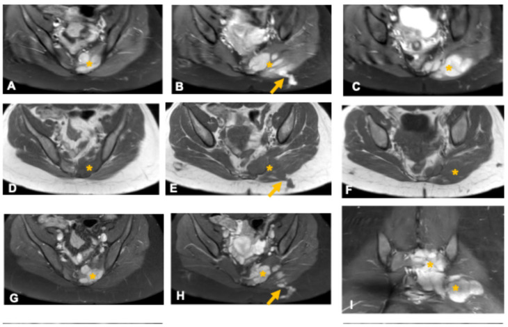Figure 13