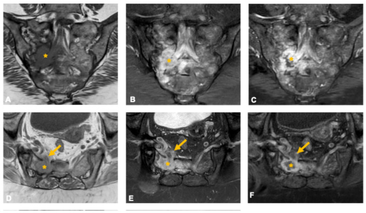 Figure 14