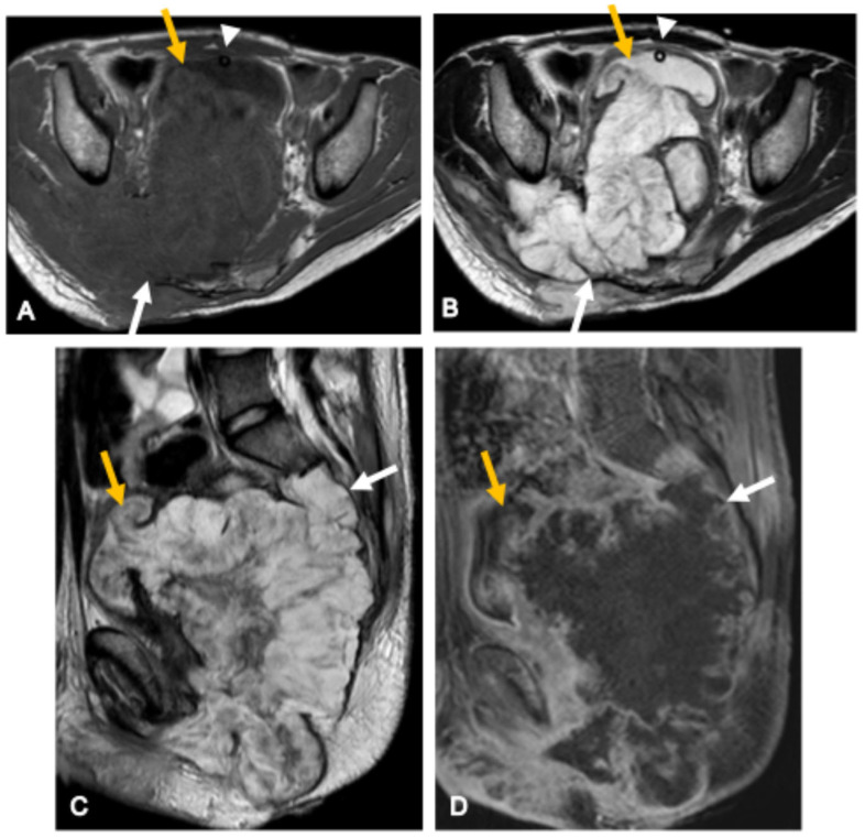 Figure 15