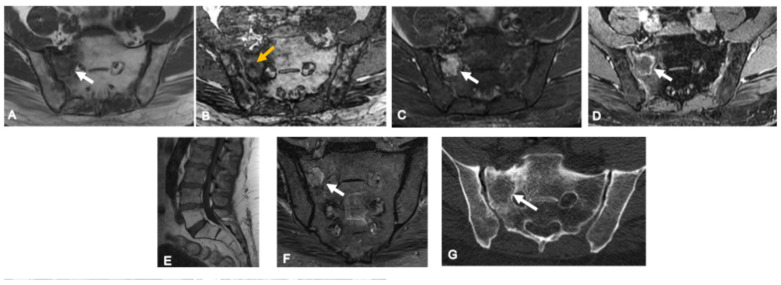 Figure 16