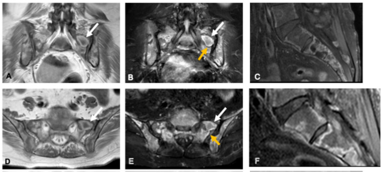 Figure 17