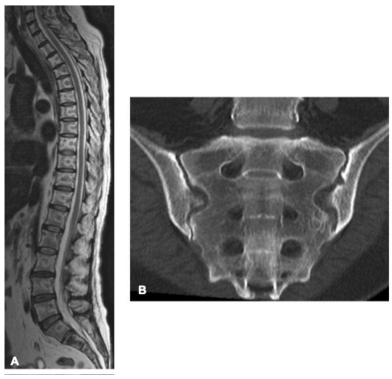 Figure 18