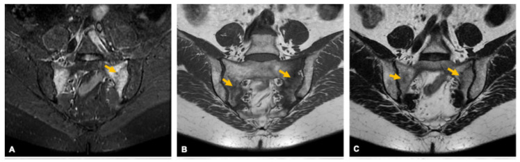 Figure 19