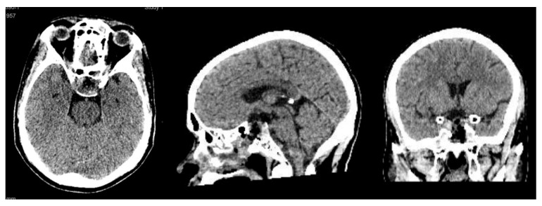 Figure 5