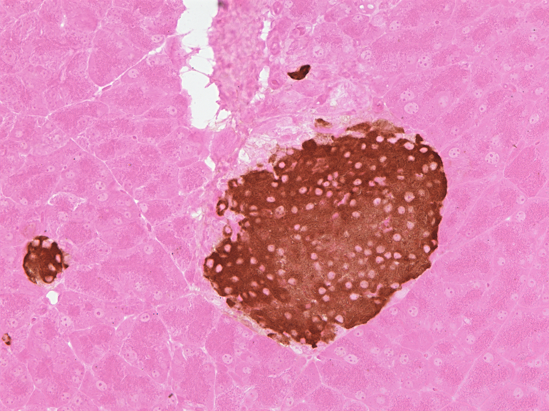 Figure 17