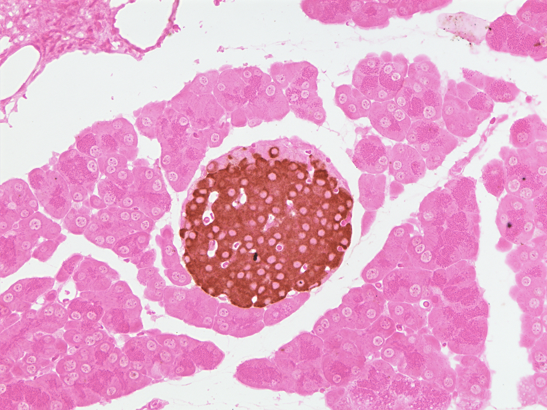 Figure 18