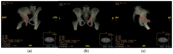 Figure 6