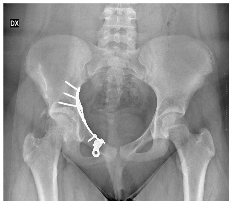 Figure 7