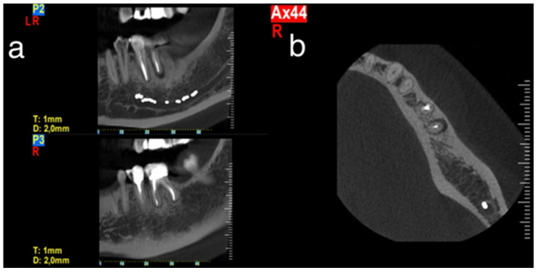 Figure 12