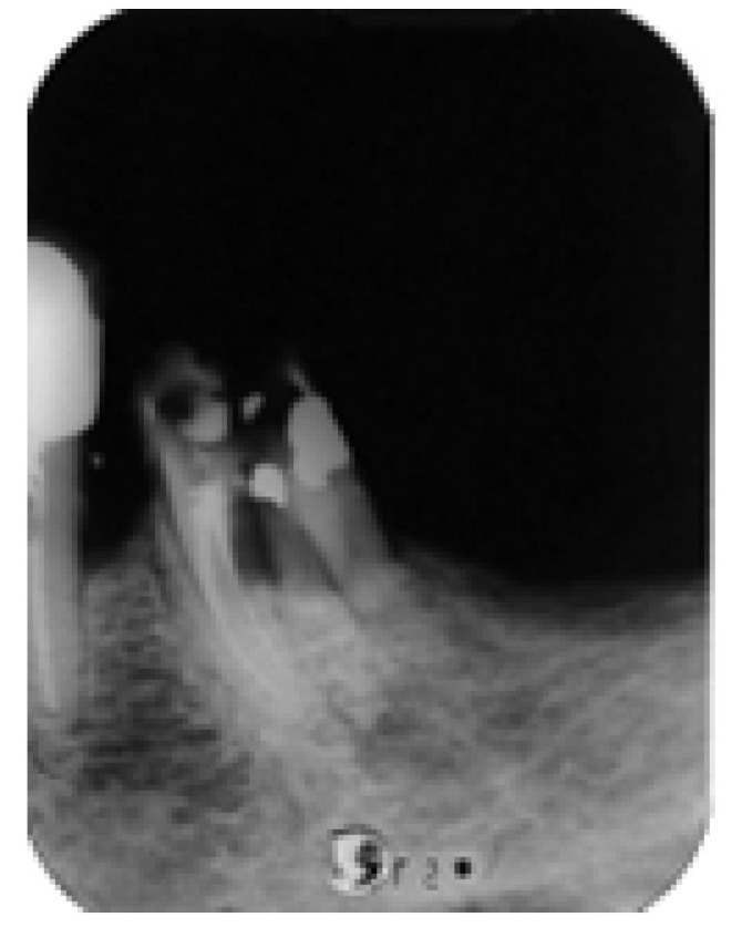 Figure 16