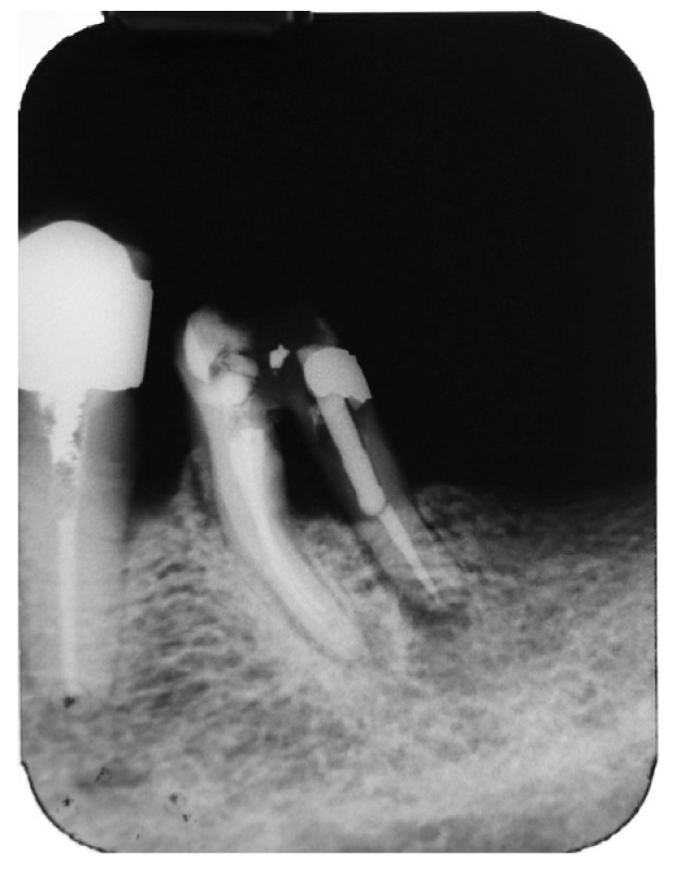 Figure 17