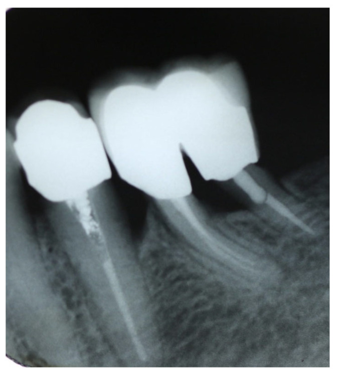 Figure 18